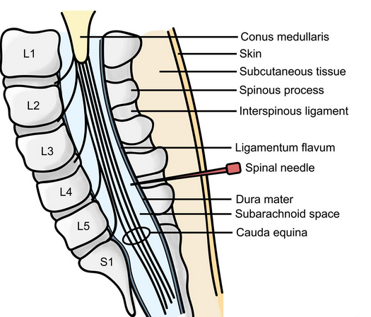 File:Lateral spine.png