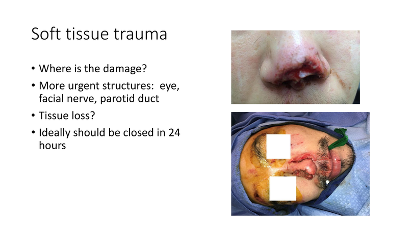 File:Facial Trauma - 4-4-2019.pdf