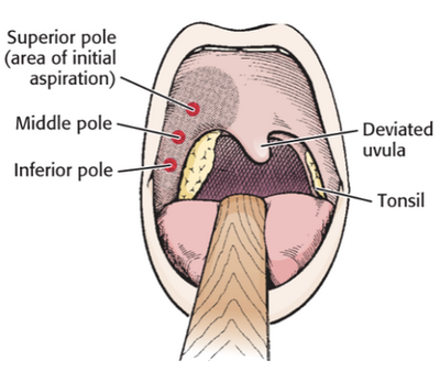 Posterior oropharynx.png
